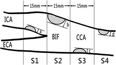 Vascular, Cognitive, and Psychomental Survey on Elderly Recycling Volunteers in Northern Taiwan